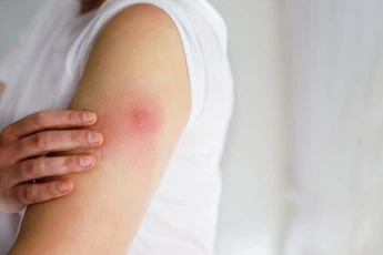 What Are The Side Effects Of Mots-C