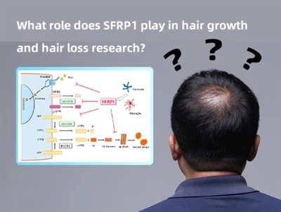 Che ruolo gioca SFRP1 nella ricerca sulla crescita e sulla perdita dei capelli