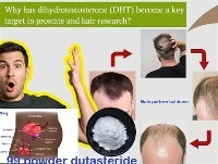 Perché il DHT è diventato un obiettivo chiave nella ricerca sulla prostata e ...